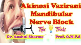 AKINOSI VAZIRANITECHNIQUELANDMARKSCLOSED MOUTHMANDIBULAR NERVE BLOCKCOMPLICATIONSMALAMED [upl. by Aldora852]