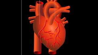 Attaque cardiaque infarctus du myocarde [upl. by Akined]