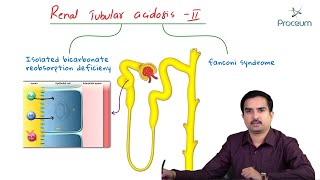 Fanconi syndrome  Proximal  Type 2  Renal Tubular Acidosis  Usmle [upl. by Aket287]