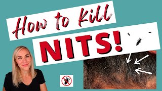 How to Kill Nits amp Lice Eggs Tutorial [upl. by Snyder621]