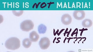 This is NOT Malaria What is it An Important Mimic of Plasmodium vivax Gametocyte on Blood Smear [upl. by Takakura]