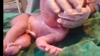 New born female baby came deliver through normal baby is so beautifull removing vernix baby is🥰💙🖤 [upl. by Amadas]