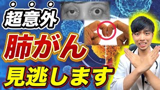 【岩井社長が進行がん】知らないと後悔する肺がんの危険なサイン4選【なぜ報道されない？】現役医師が解説 [upl. by Mulvihill920]