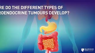 Symptoms Types and Diagnosis of Neuroendocrine Tumours NETs [upl. by Atiloj]