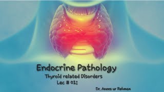 Endocrine Pathology  Hashimotos Thyroiditis lec 01 Pathology robbinsbasicpathology concept [upl. by Fagen]