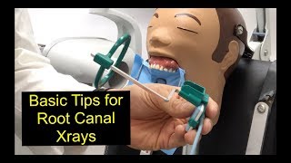 Basic Tips for Root Canal Xrays [upl. by Hiroshi]