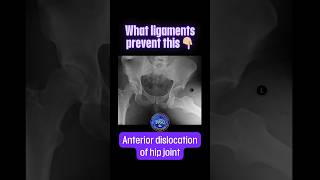 What ligaments prevent the anterior dislocation of hip joint shorts drsamsanatomyclasses [upl. by Pacificia]