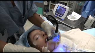 GlideScope Pediatric Airway Rounds Case Study 4 yearold Goldenhar Syndrome [upl. by Mcgrody]