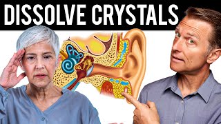 How to Dissolve Crystals in the Inner Ear and Get Rid of Vertigo [upl. by Anyrb]