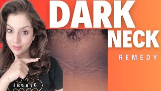 Dark Neck Treatment at Home I Dark Neck Remedy I Acanthosis Nigricans Treatment [upl. by Queridas144]