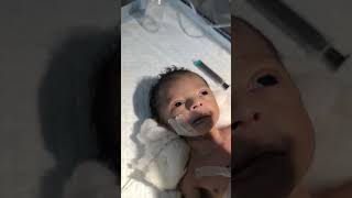 Chestryped for newborn baby😌 sumitnicunursingstm youtubeshorts nursing newbornbaby chestworkout [upl. by Cavil]