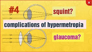 HYPERMETROPIA [upl. by Arekat347]