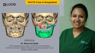 Atrophic Maxilla Rehabilitation with Titanium PSI  First Case in Bangladesh [upl. by Gershon]