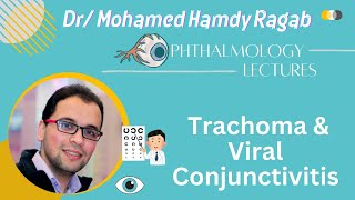 Conj 2 Trachoma amp Viral Conjunctivitis [upl. by Amlus]