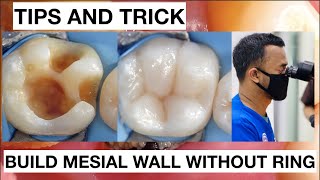 Tips and trick How To Build Mesial Wall Without Ring Clamp  General Dentist Griya RR [upl. by Starlene]