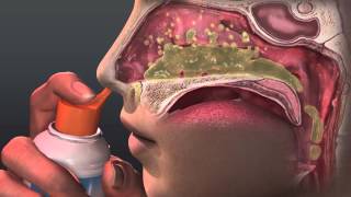 Can Saline Irrigation Help Nasal Allergies Animated Guide to Saline Nasal Irrigation [upl. by Gipps]