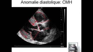 Dossier PAE Cardiologie 03 [upl. by Jamieson616]