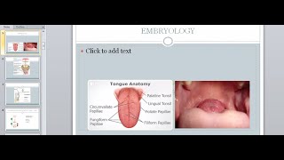 Thyroid Disorders  Hypo and Hyperthyroidism  Surgery Lecture [upl. by Enenej]