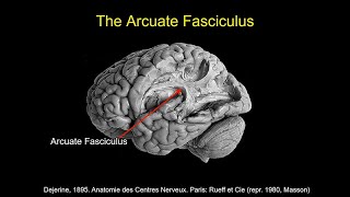 CARTA Comparative Anthropogeny Human Arcuate Fasciculus [upl. by Sauer]