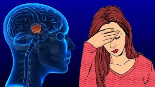 Pituitary Gland Disorders Symptoms And Treatment [upl. by Aneala]