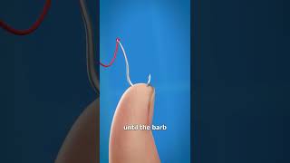 How To Remove A Fishhook 😱 [upl. by Nosirrah143]