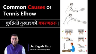 Tennis Elbow Common Causes and How to Avoid It  Dr Ragesh Karn tenniselbow neurologist [upl. by Sopher3]