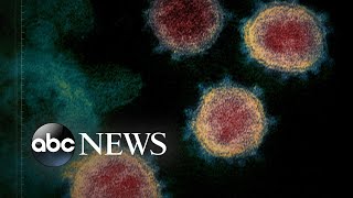 Case of ‘community spread’ of coronavirus in US raises concerns  WNT [upl. by Faro]