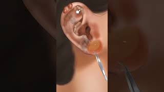 5item ear cleaning amp earring set asmr treatment [upl. by Anitahs]