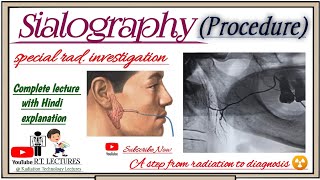 Sialography Procedure Complete Lecture Sialography radiology complete video Lecture in hindi [upl. by Malcah]