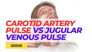 Carotid Artery Pulse Vs Jugular Venous Pulse  Physiology [upl. by Dodson]