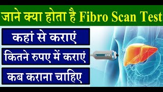 जाने क्या होता है Fibro Scan Test  कैसे किया जाता है Fibro Scan Test  कितने रुपए में कराएं [upl. by Kathryne923]