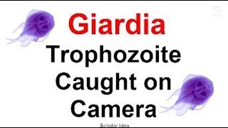 Giardia trophozoite Caught on Camera  جيارديا تحت الميكرووسكوب [upl. by Nilorac839]