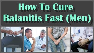 How To Cure Balanitis With Oils Fast And Causes Symptoms And Treatment Of Balanitis [upl. by Anyel]