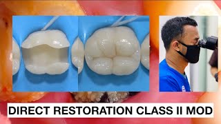 Direct Restoration Class II Composite  Practice  Dokter gigi Griya [upl. by Venable362]