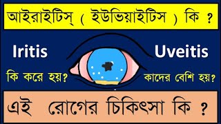 anterioruveitis iritis Iritis or Anterior uveitis symptoms signs and treatment discussed [upl. by Romelda352]