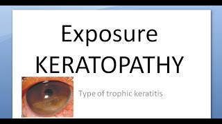 Ophthalmology 124 a Exposure KERATOPATHY Keratitis Causes Corneal Dry [upl. by Undine]