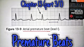 Premature contractions  chapter 13 part 37  Guyton and Hall text book of physiology [upl. by Riesman114]