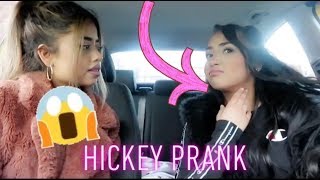 Hickey Prank On Sister  Abira amp Dúaa [upl. by Geis315]