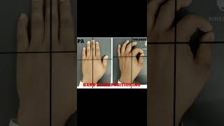 Hand x ray positioning short video [upl. by Solorac111]