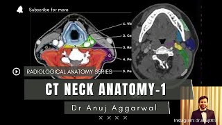 CT Neck Anatomy Radiology Basics Anuj Aggarwal [upl. by Anyzratak]