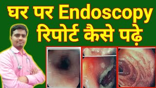 How To Read Endoscopy Report at Home  Endoscopy report explained  Endoscopy reading  Endoscopy [upl. by Bergeron]