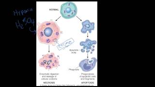 4  Introduction to Pathology  Necrosis vs Apoptosis [upl. by Adriene]