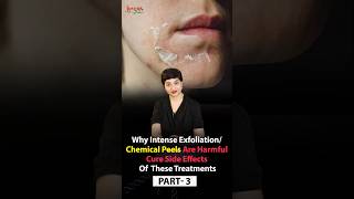 How to Heal amp Protect Your Skin Barrier PostExfoliation  Protecting Your Skin After Chemical Peels [upl. by Orteip]