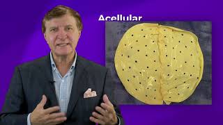 Acellular Dermal Matrix Complications Plastic Surgery Hot Topics with Rod J Rohrich MD [upl. by Chrissy]