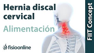 Hernia discal cervical derecha Alimentación nutrición y modificaciones en la dieta [upl. by Simaj550]