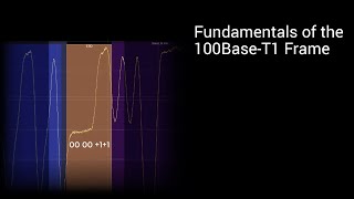 Fundamentals of the 100BaseT1 Frame [upl. by Witt547]