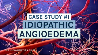 Idiopathic Angioedema  Case Study 1 The Inflammation Files with Dr Kara Wada [upl. by Eerat494]