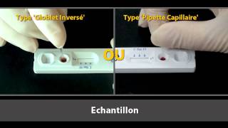 SD BIOLINE Malaria Ag Pf Pan French [upl. by Rick]