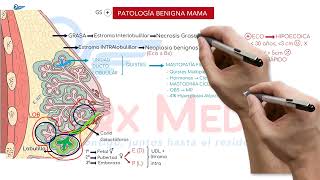 Ginecología  12 Patología mamaria benigna [upl. by Eirehc]