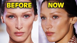 Top 10 Celebrities That REVERSED Their Botched Plastic Surgery [upl. by Luanne]